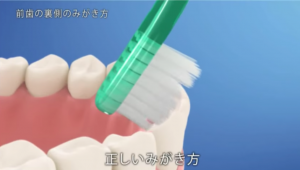前歯の裏側のみがき方