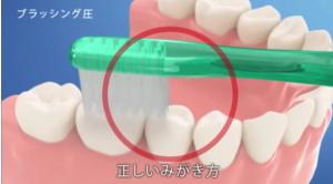 ブラッシング時の力加減