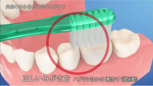 奥歯のかみ合わせ面のみがき方