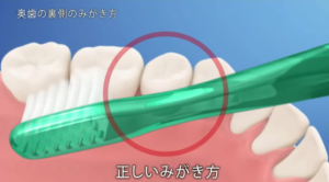 奥歯の裏側のみがき方